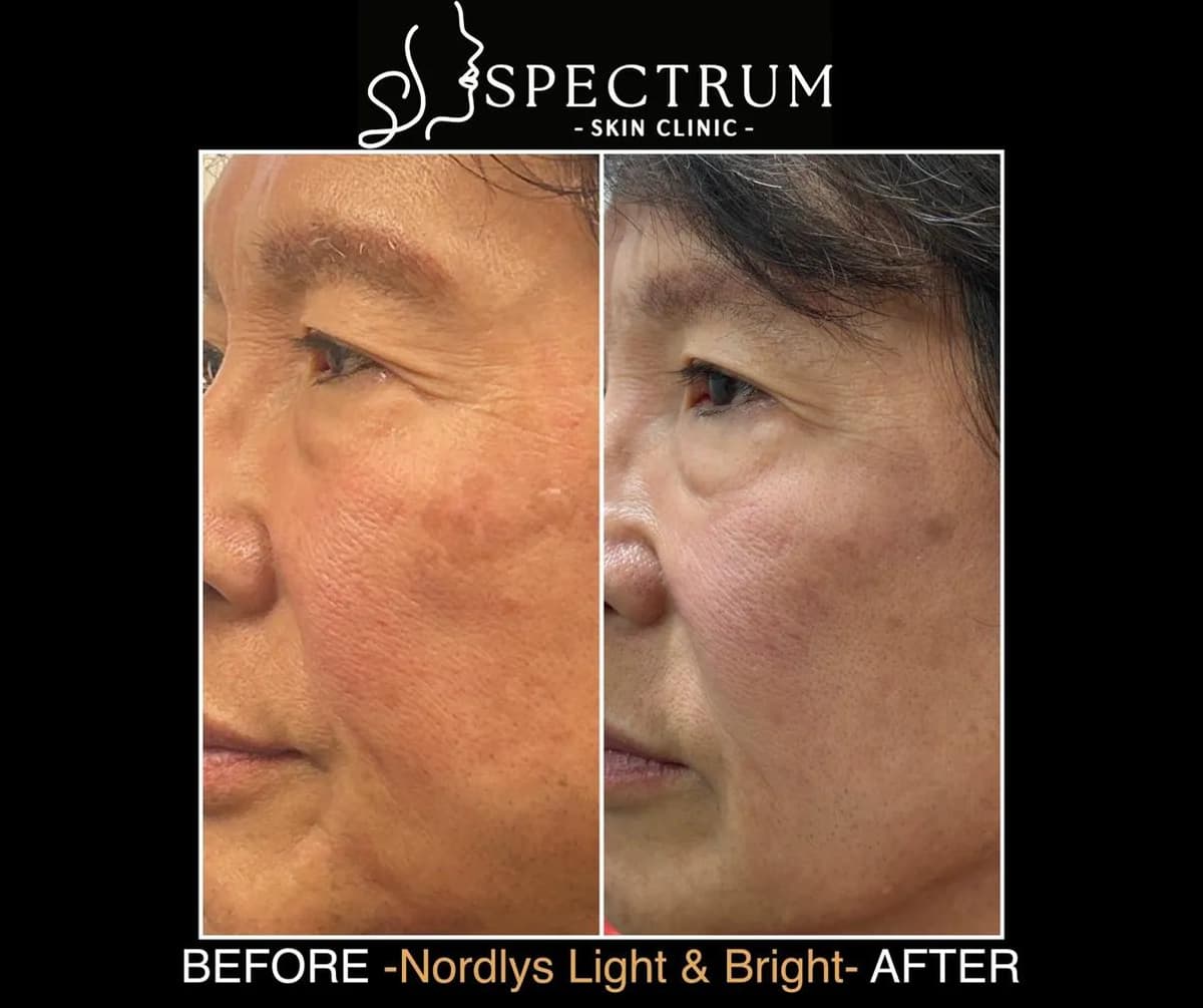 The Treatment Process and What to Expect